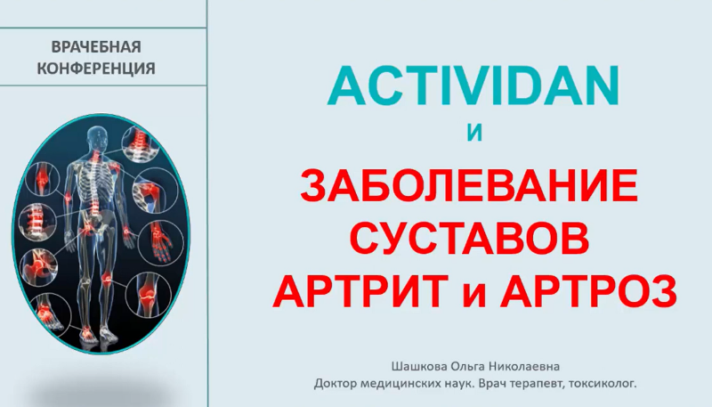 Врачебная конференция №5 - ACTIVIDAN и ЗАБОЛЕВАНИЕ СУСТАВОВ, АРТРИТ и АРТРОЗ