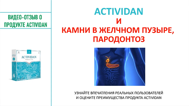 N110 Отзыв применения продукта ACTIVIDAN - КАМНИ В ЖЕЛЧНОМ ПУЗЫРЕ, ПАРОДОНТОЗ