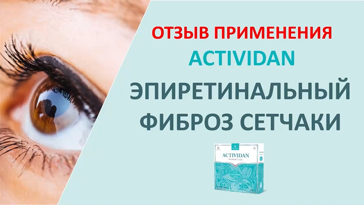 N24 Отзыв применения продукта ACTIVIDAN - ЭПИРЕТИНАЛЬНЫЙ ФИБРОЗ СЕТЧАТКИ