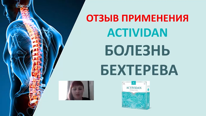 N37 Отзыв применения продукта ACTIVIDAN - БОЛЕЗНЬ БЕХТЕРЕВА