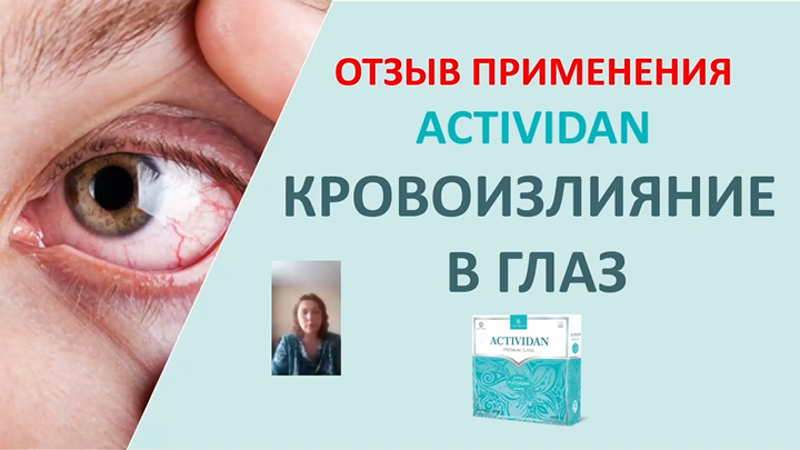 N41 Отзыв применения продукта ACTIVIDAN - КРОВОИЗЛИЯНИЕ В ГЛАЗ