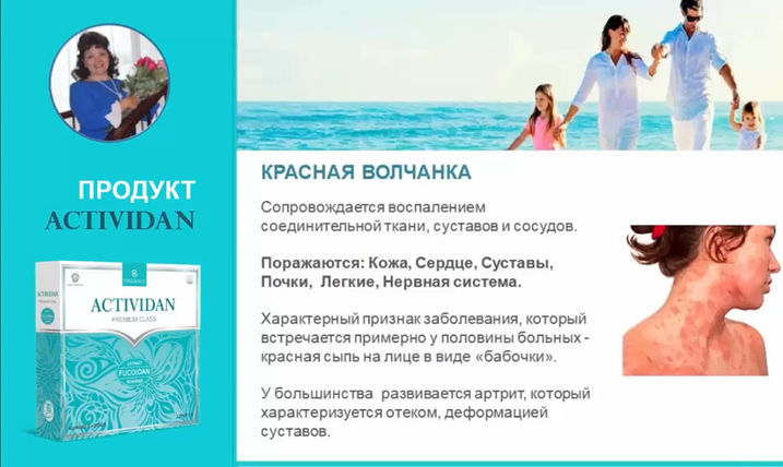 N51 Отзыв применения продукта ACTIVIDAN - КРАСНАЯ ВОЛЧАНКА