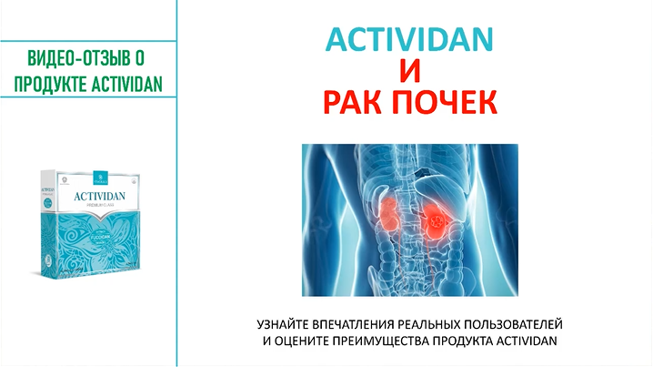 N89 Отзыв применения продукта ACTIVIDAN - РАК ПОЧЕК