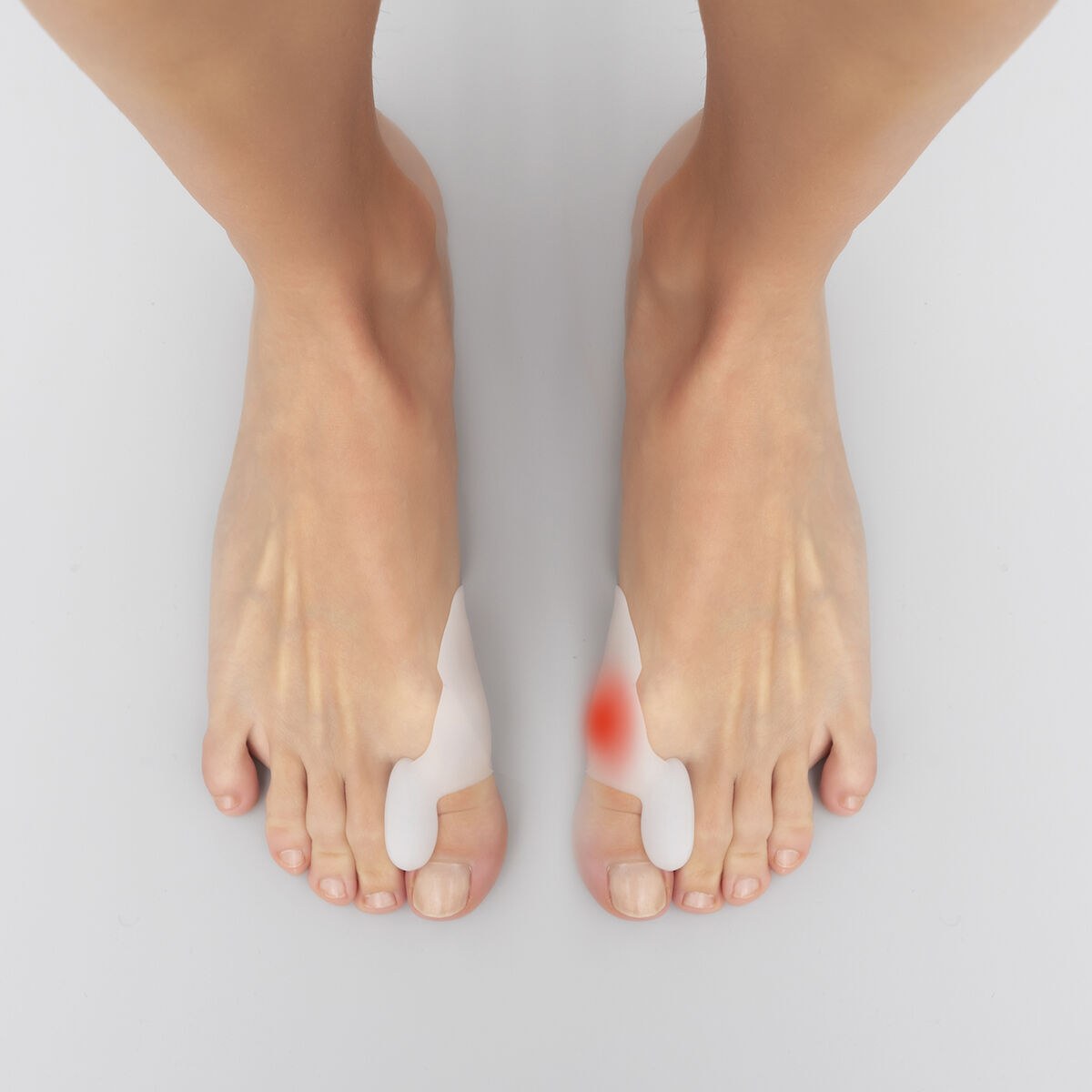 Silicone Bunion Corrector Protector Bunilief 2 Units