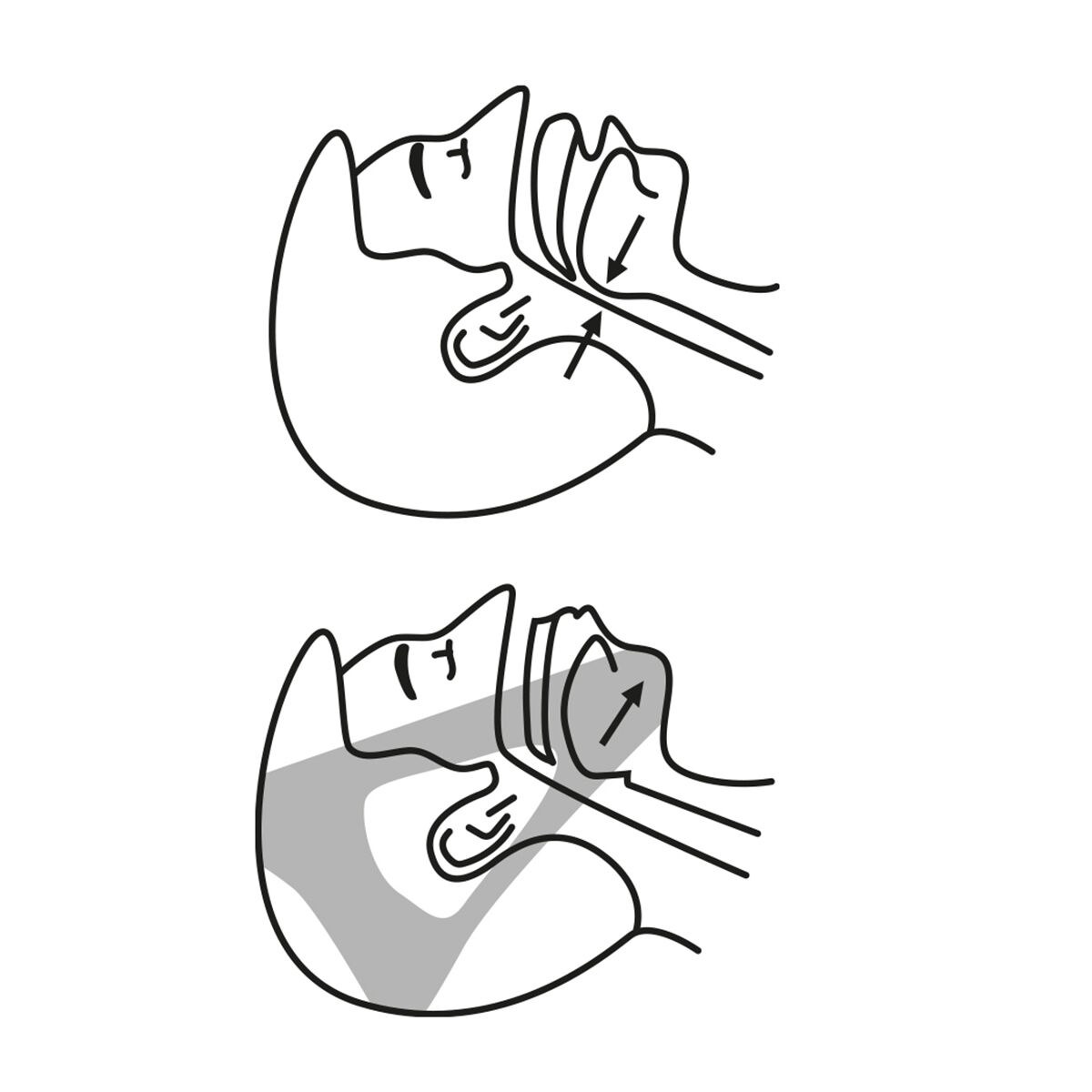 Anti-snoring Band Stosnore